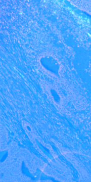 04_Icon_Web_molecular-diagnostics_BG